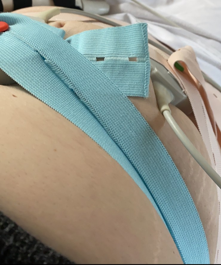 Photo of a white pregnant persons midriff, with blue and pink elastic bands holding 2 grey discs to the stomach area with grey colour wires going off to the right of the photo.